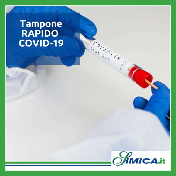 Test rapido covid 19